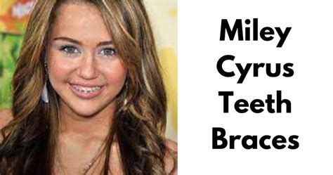 brace cyrus|More.